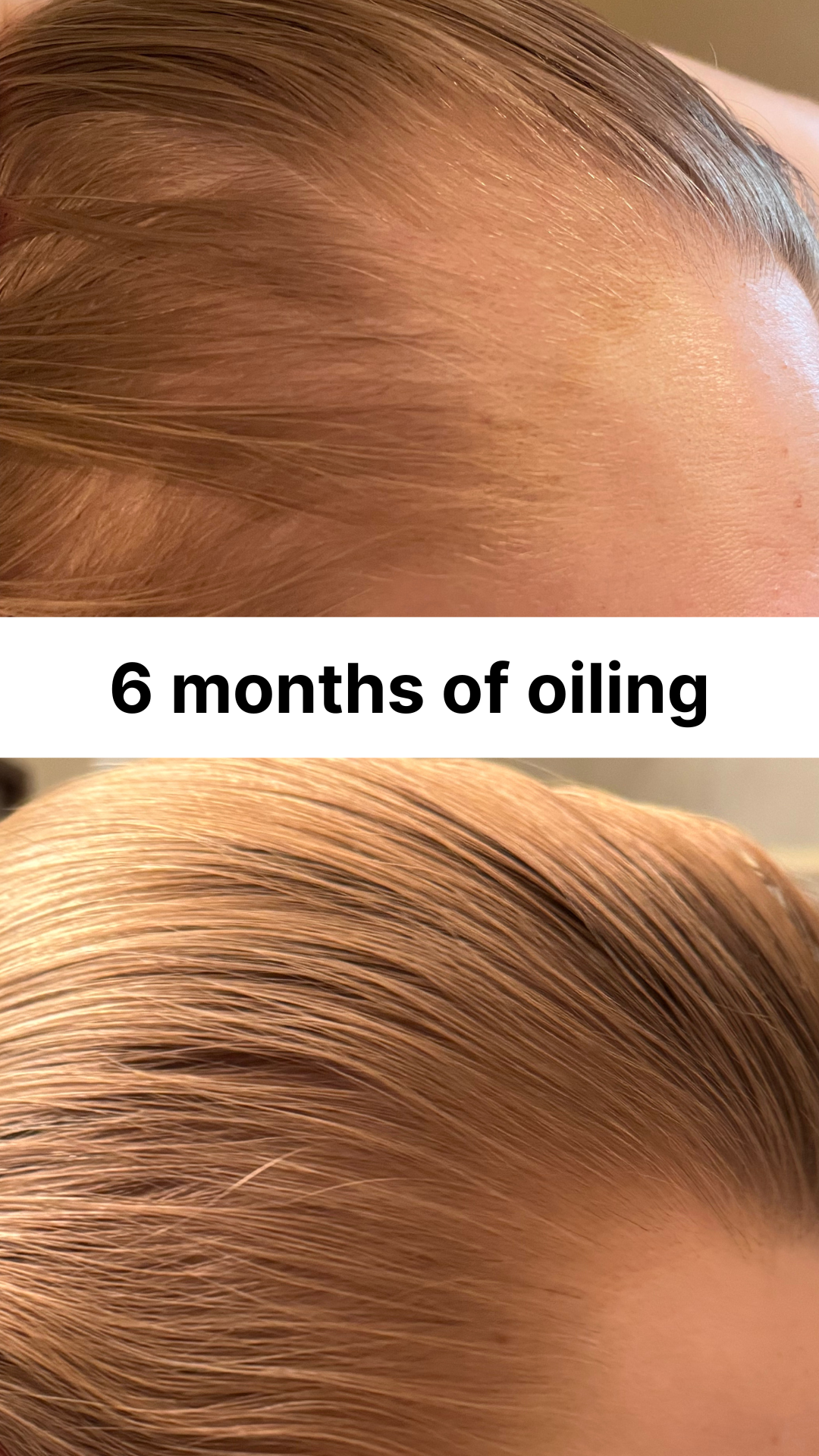 Rosemary Hair Growth Oil